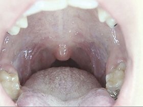 300人のおくち 第2集　サンプル画像02